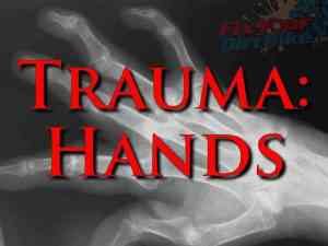 First Aid: Trauma - hand Injuries