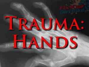 First Aid: Trauma - Hands